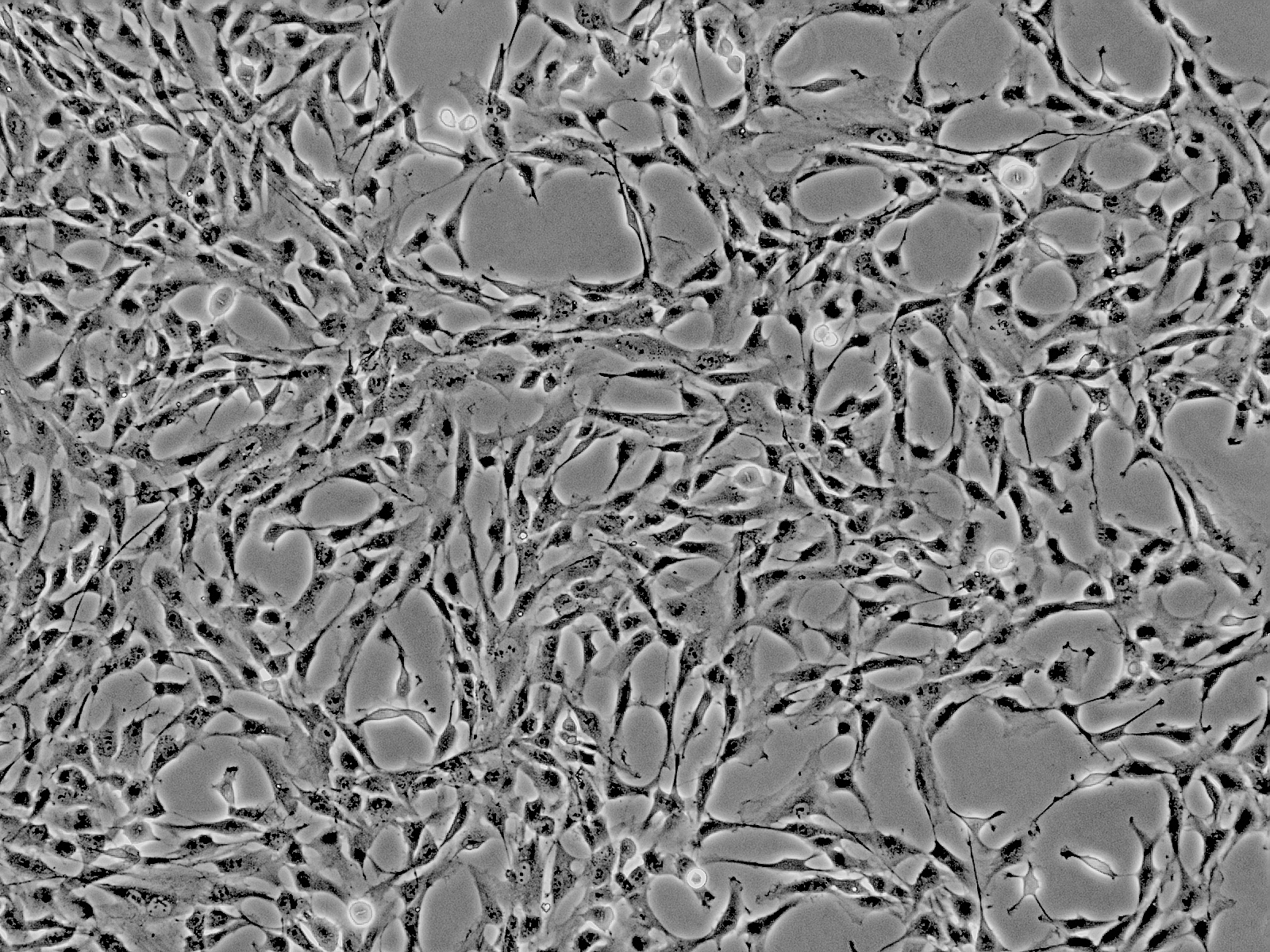 人肝脏间充质干细胞 hmsc-he